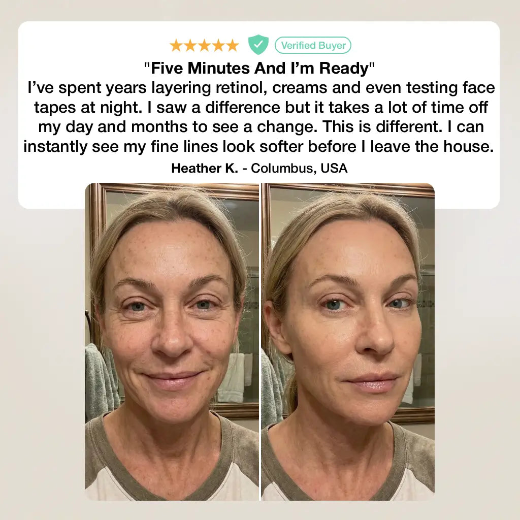 Dermelle™ Instant Fine Line & Wrinkle Eraser