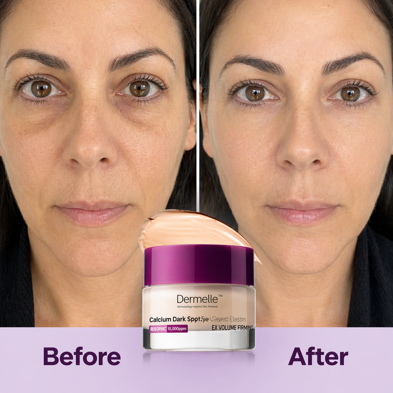 Dermelle™ Dark Spot Correcting Eye Cream