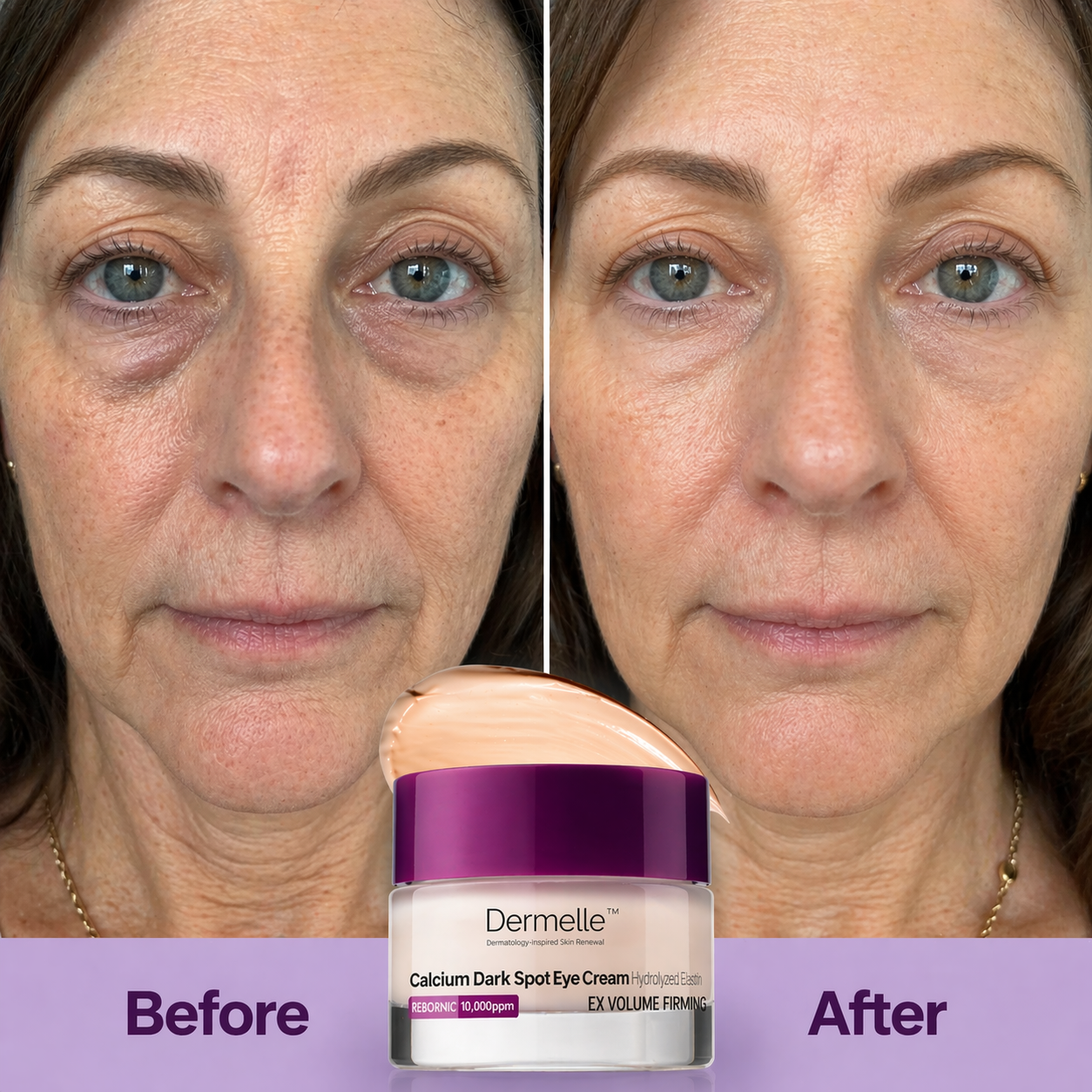 Dermelle™ Dark Spot Correcting Eye Cream